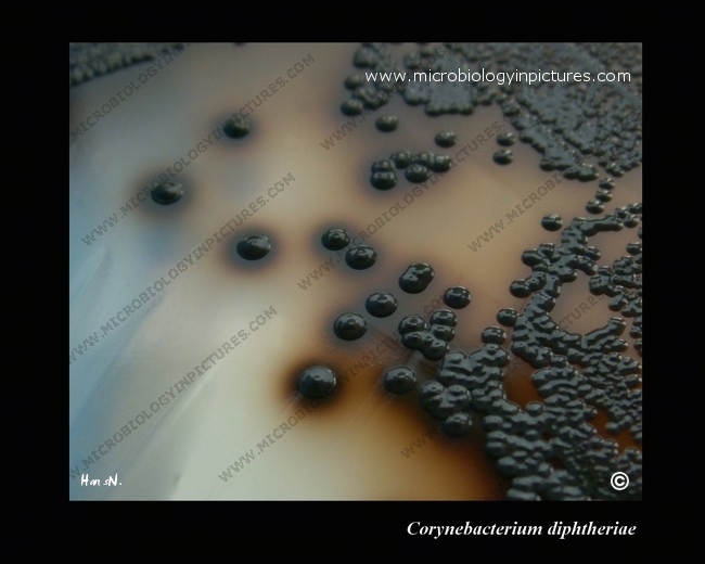 corynebacterium diphtheriae surrounded by black halo on Tinsdale agar